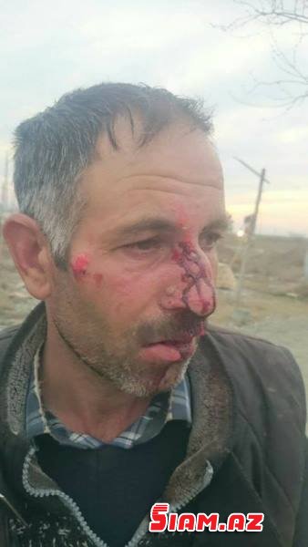 Başçı müavini Xocalı faciəsi günü Xocalı sakinini döydürüb – Foto Başçı müavini Xocalı faciəsi günü Xocalı sakinini döydürüb – Foto