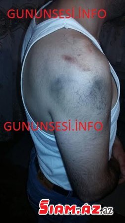 Gəncə polisində vətəndaşı bu hala saldılar- FOTOLAR Gəncə polisində vətəndaşı bu hala saldılar- FOTOLAR