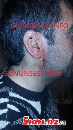 Gəncə polisində vətəndaşı bu hala saldılar- FOTOLAR Gəncə polisində vətəndaşı bu hala saldılar- FOTOLAR