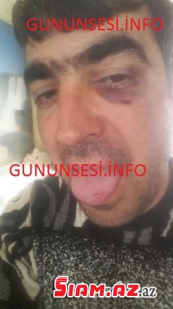 Gəncə polisində vətəndaşı bu hala saldılar- FOTOLAR Gəncə polisində vətəndaşı bu hala saldılar- FOTOLAR