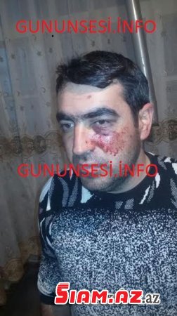 Gəncə polisində vətəndaşı bu hala saldılar- FOTOLAR Gəncə polisində vətəndaşı bu hala saldılar- FOTOLAR
