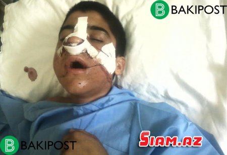 Müəllim şagirdi qanına qəltan elədi, həkimlər başına oyun açdı - Tükürpədici olay - Fotolar Müəllim şagirdi qanına qəltan elədi, həkimlər başına oyun açdı - Tükürpədici olay - Fotolar